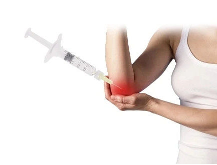 3 ml nicht vernetzte Mesotherapie-Injektionen 5 ml Mesotherapie-Hautstraffung