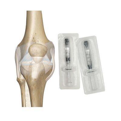 Arthrose Hyaluron-Gel-Injektion Hyaluron-Injektion Knie Knieschmierung