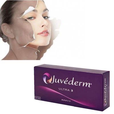 Hyaluronic Dermal Juvederm Ultra 3 Lip Filler Subtile Wangenfüller für das Gesicht