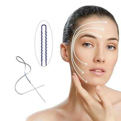 Augenbrauen-Aufzug-Gesichtsbehandlung PCL Pdo, die Monoschraube 30G 25MM des Facelift-4d 6d verlegt