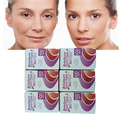 Botulinumantigiftstoff Allergan-Einspritzungs-Art  der falten-100Units