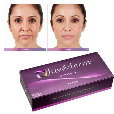 Hyaluronsäure Juvederm Gesichtsfiller Gel Glatte und makellose Haut