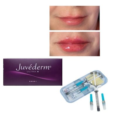 6-9 Monate Dauer Juvederm Dermal Filler Gel zum Online- und im Ladenkauf