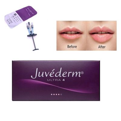 2 ml Gesichtspflege Juvederm Cross Linked Dermal Filler Hyaluronsäure Injektion