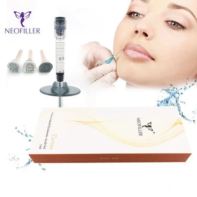 Neofiller 2 ml Hyaluronsäure Hautfüllmittel Lido Injektionsgel Gesichtsverjüngung
