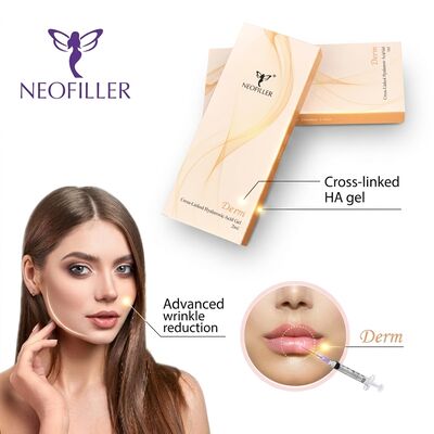 6- 8 Monate Wirkungsdauer Hyaluronsäure Dermische Füllung mit biokompatibler Hyaluronsäure in 1 ml Spritze Volumen zur Faltenreduktion