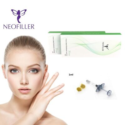 1 ml Hyaluronsäure Hautfüllmittel Injektionsgel Wange Kinn Nasenkontur Skulptur Sichere Lösung in hoher Konzentration