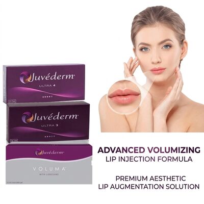 Volumen der Spritze 2 1 ml pro Schachtel Juvederm Volumen Füllstoff Sicherheit Gesichtskontur Injektierbarer Hautfüllstoff zur Volumenvergrößerung