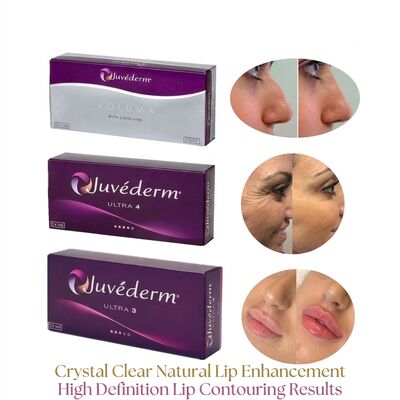 Volumen der Spritze 2 1 ml pro Schachtel Juvederm Volumen Füllstoff Sicherheit Gesichtskontur Injektierbarer Hautfüllstoff zur Volumenvergrößerung