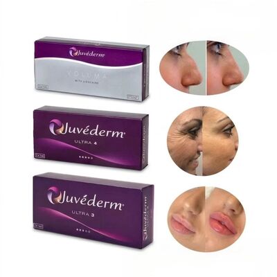24 mg/ml Juvederm Lippenfüller Juvederm Ultra3 Ultra4 Voluma injizierbar