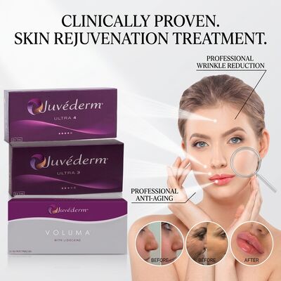 Juvederm Ultra 3 Nasolabial Fold Filler Hyaluronsäure Hautfiller zur Glättung von Lächellinien 24 mg/ml