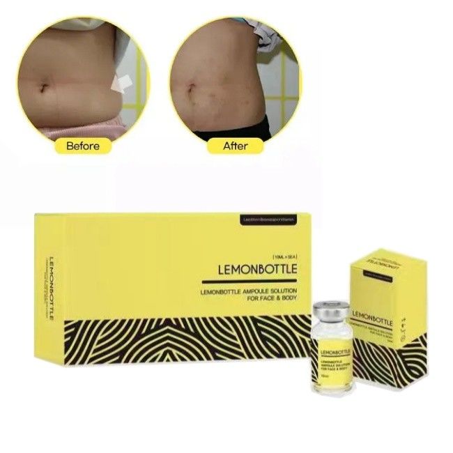 Zitronenflaschenlösung mit hoher Konzentration zur Fettlösung für Injektionen 5 Durchstechflaschen X 10 ml ganzer Körper