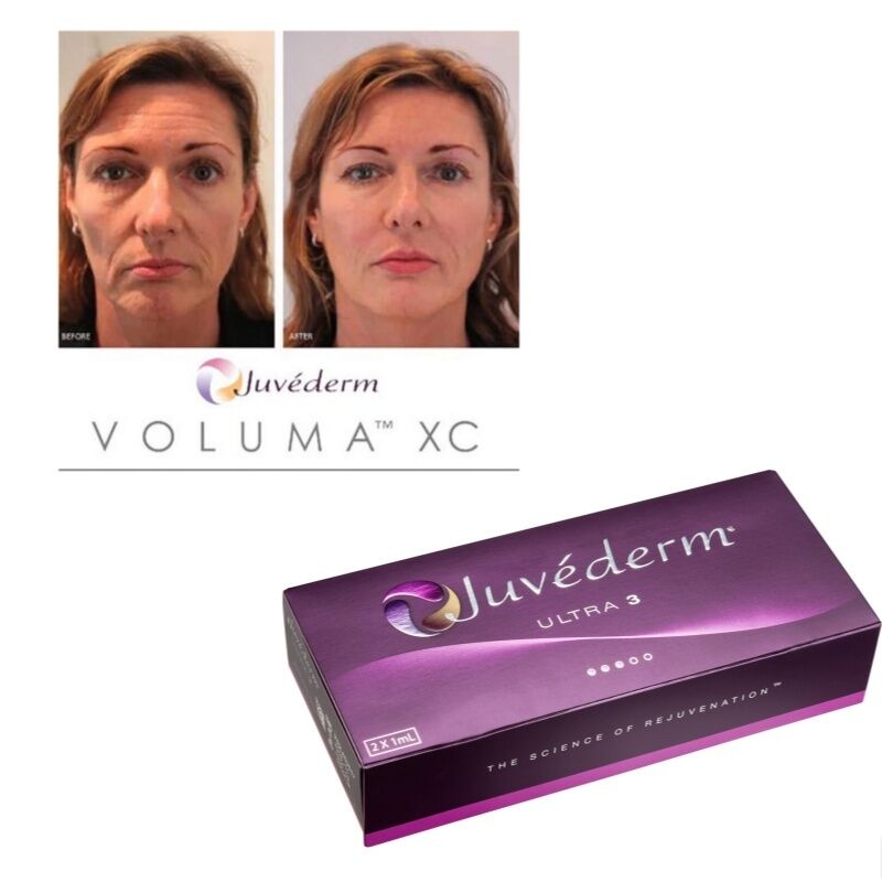 Faltenkorrektur Juvederm Hautfüllmittel Hyaluronsäure Injektionsgel Langlebige Glättungsbehandlung
