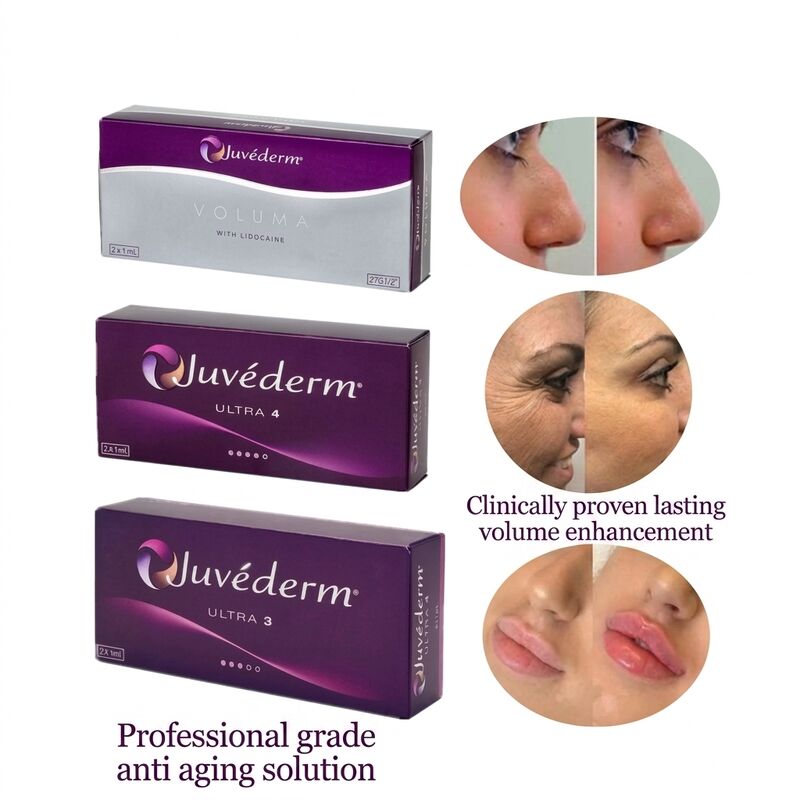Plastische Chirurgie Juvederm Dermal Filler Konzentration 20mgMl Langlebigkeit 9-12 Monate Geeignet zur Verbesserung der Gesichtskonturen und der Hautverjüngung